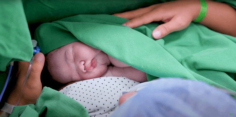 Mẹ mang thai lần 2 bị đau vết mổ đẻ cũ phải làm sao?