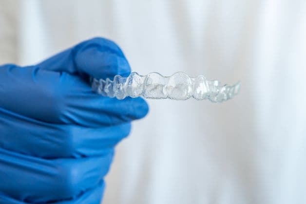 Ê răng khi đeo hàm duy trì do đâu?