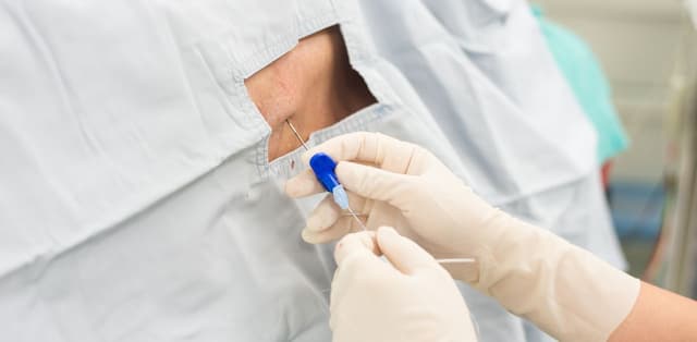 Sự khác nhau giữa gây tê tuỷ sống và gây tê ngoài màng cứng