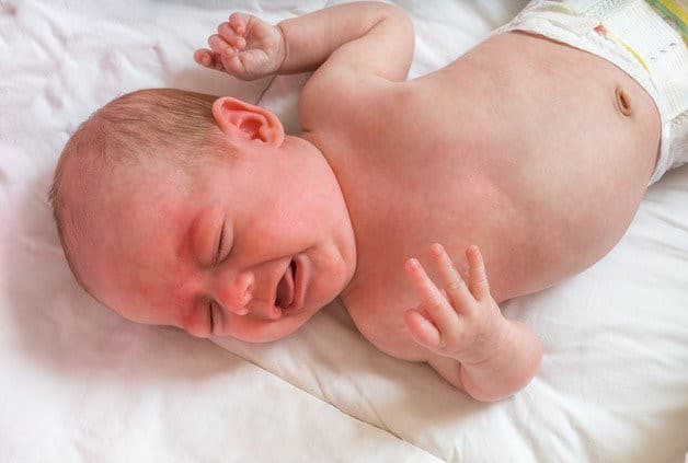 Triệu chứng bệnh động kinh - hội chứng West