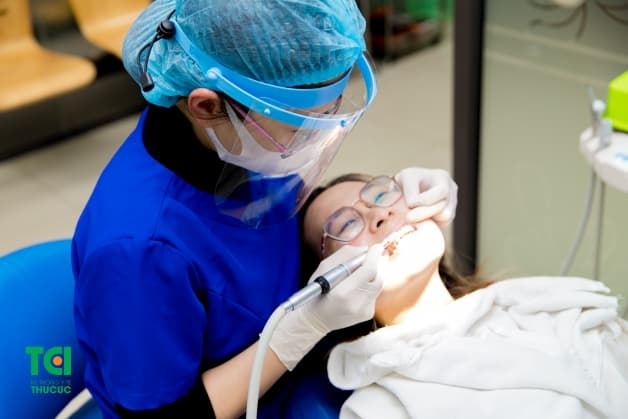 lấy cao răng tại nhà đơn giản