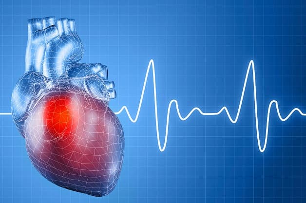 Nguyên nhân gây suy tim cấp