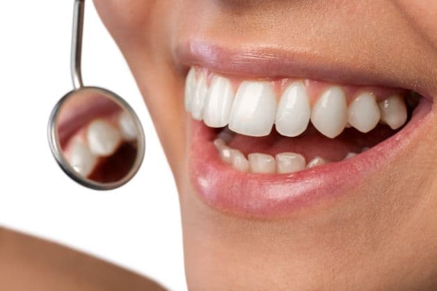 Lưu ý gì khi nhổ răng nanh?