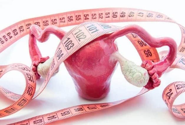 Trong trường hợp khối u xơ lớn hơn 10cm không sử dụng được phương pháp nút mạch