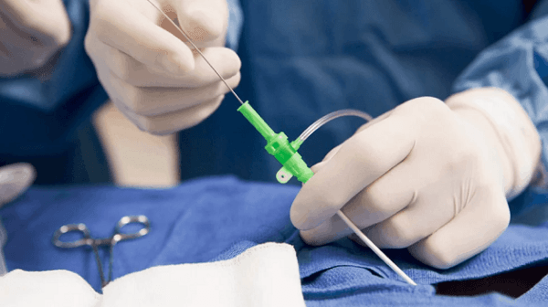 Sinh thiết gan có nguy hiểm không qua Catheter