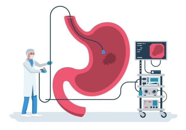 Ung thư dạ dày có thể sống được bao lâu và lời giải đáp