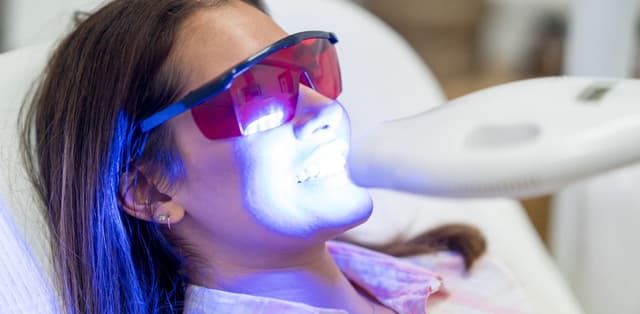 Tìm hiểu về phương pháp tẩy trắng răng?