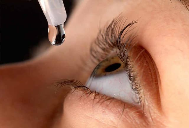 Vai trò của các loại thuốc viêm kết mạc mắt?