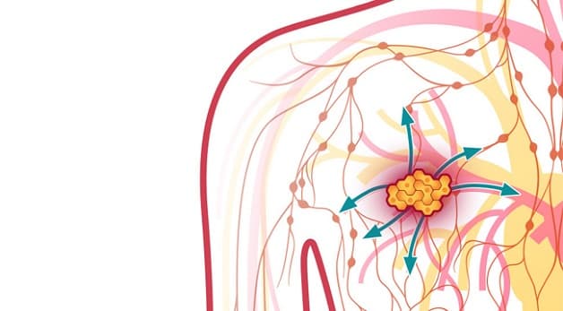 các xét nghiệm ung thư vú