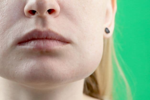 Nguyên nhân gây u hàm răng