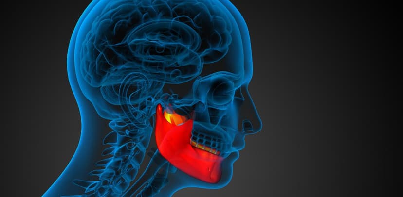 Bạn biết gì về u hàm răng?