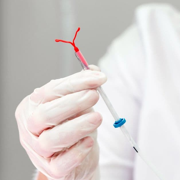 U xơ tử cung có đặt vòng được không?