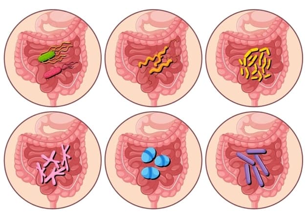 Nhiễm khuẩn là nguyên nhân phổ biến gây viêm dạ dày ruột.