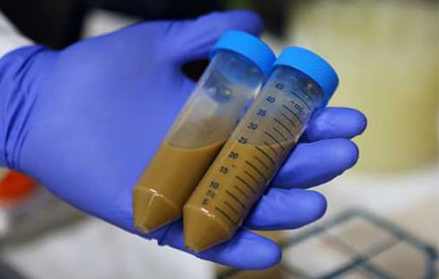 Trước khi được cấy ghép, phân người hiến được tiến hành sàng lọc và xét nghiệm nghiêm ngặt để đảm bảo rằng không có vi khuẩn gây nguy hiểm cho bệnh nhân. 