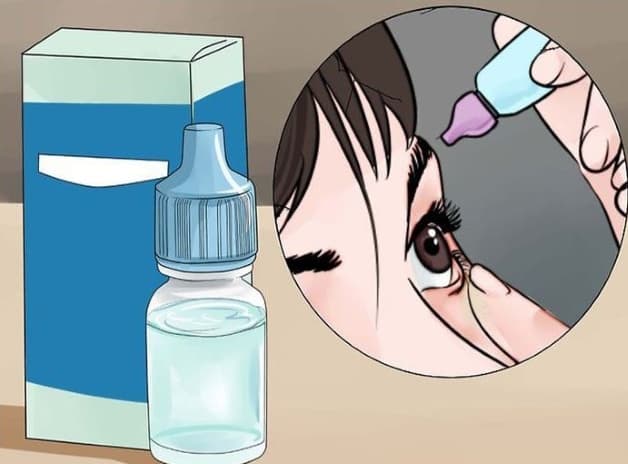 viêm kết mạc nhầy mủ điều trị