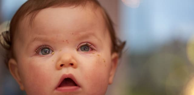 Viêm kết mạc trẻ sơ sinh có nguy hiểm không?