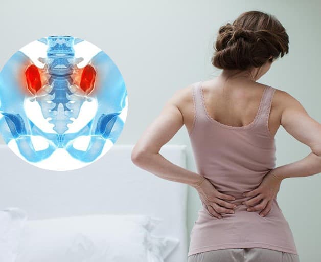 Viêm xương khớp vùng chậu gặp khá nhiều ở phụ nữ