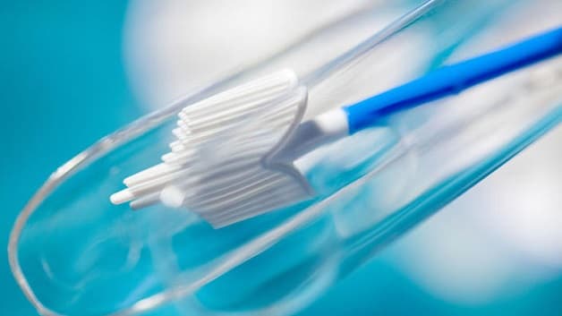 Tế bào được phết lên một lam kính trước khi xét nghiệm.phương pháp tầm soát ung thư cổ tử cung là gì