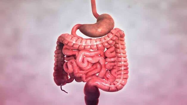 Bệnh viêm ruột Crohn gây tổn thương ở nhiều vị trí trong đường ruột