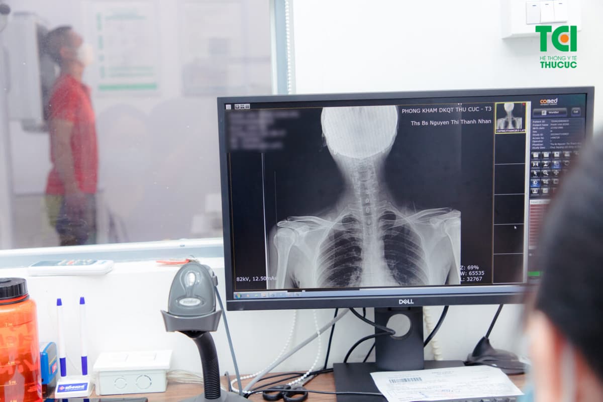 Biểu hiện thoái hóa cột sống cổ và cách phòng bệnh