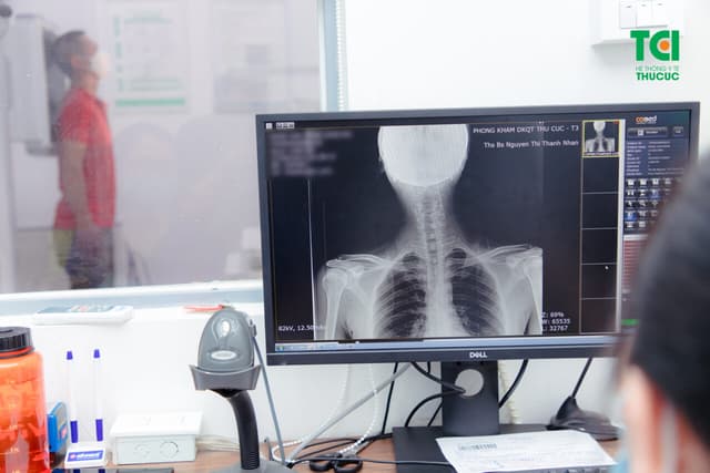 Biểu hiện thoái hóa cột sống cổ và cách phòng bệnh