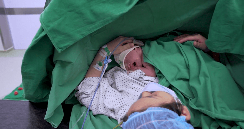 Cách gọi sữa về sau sinh mổ nhanh nhất