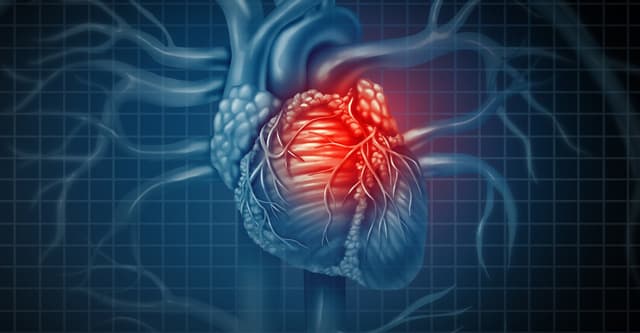 Hẹp van 2 lá: Nguyên lý, triệu chứng và cách điều trị