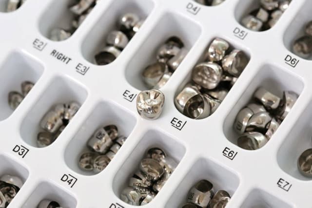 Bọc răng sứ Inox: Ưu điểm và hạn chế