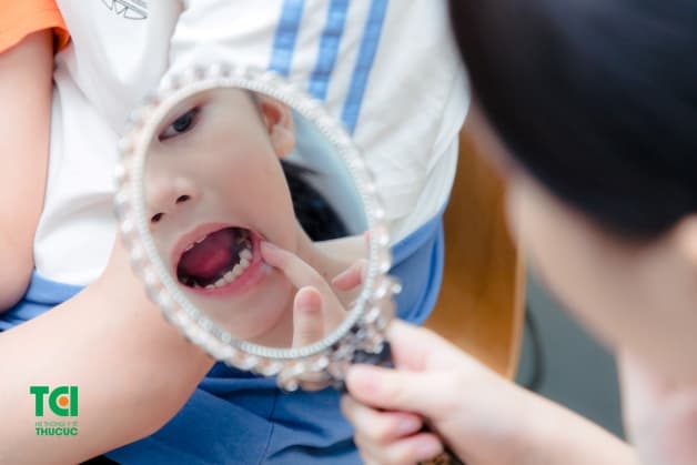 chăm sóc răng cho trẻ mầm non
