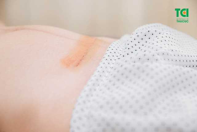 Sau đẻ mổ 4 tháng lại có bầu phải làm sao?