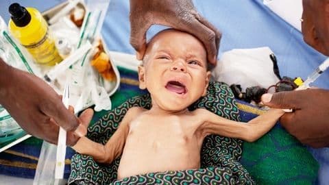 hậu quả của suy dinh dưỡng