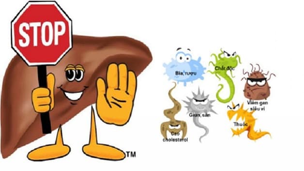 người mắc bệnh gan nhiễm mỡ kiêng gì giúp cải thiện bệnh?