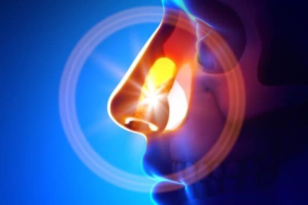 Mắc dị vật trong mũi là cấp cứu thường gặp ở trẻ nhỏ