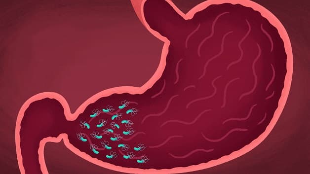 Các mẹo chữa viêm hang vị dạ dày