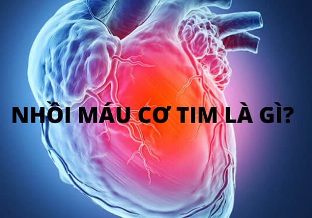 Nguyên nhân gây suy tim là gì?
