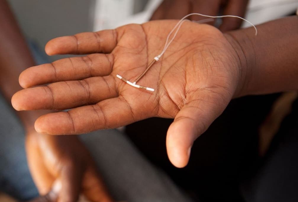 Tiến hành thủ thuật ngoại khoa trong điều kiện y tế không đảm bảo có thể là nguyên nhân viêm âm đạo