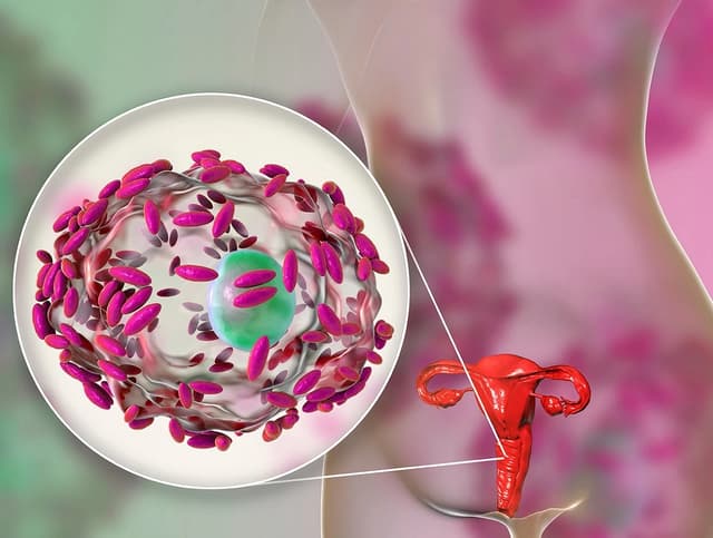 Nguyên nhân viêm âm đạo và triệu chứng điển hình nhận biết bệnh