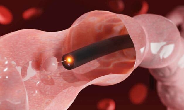 Tìm hiểu về bệnh ung thư đại tràng ở giai đoạn đầu