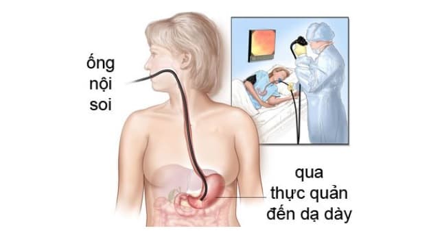nội soi nuôi cấy vi khuẩn Hp