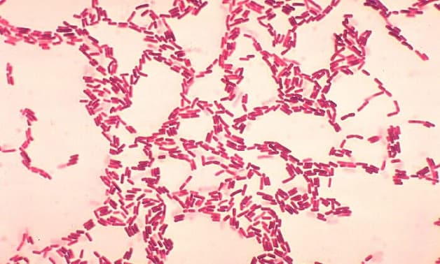 tại sao cần nuôi cấy vi khuẩn Hp