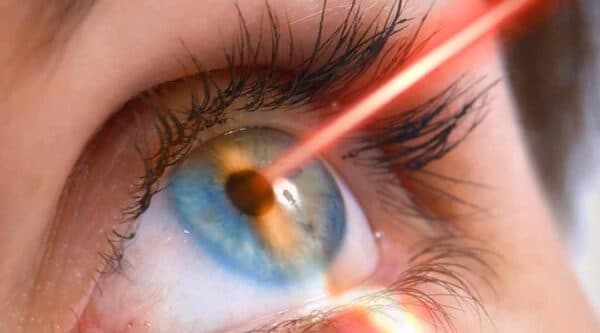 Nguyên nhân của tăng nhãn áp là gì?