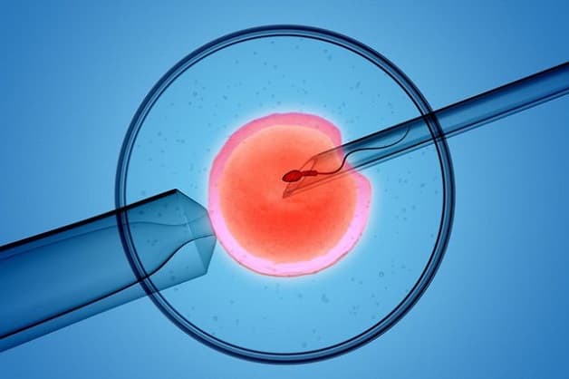 IVF - Thụ tinh ống nghiệm là kỹ thuật điều trị vô sinh, hiếm muộn phổ biến nhất hiện nay