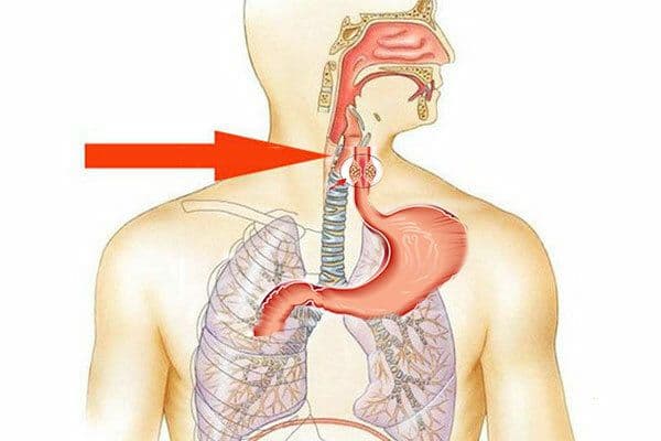 Ung thư thực quản có chữa được không