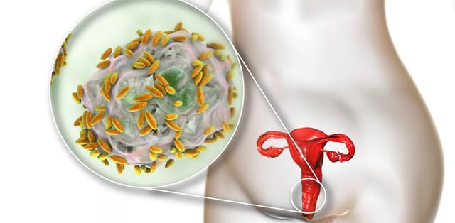 Tổng hợp các triệu chứng bị viêm âm đạo thường gặp