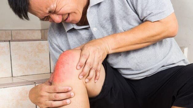 Biểu hiện thoái hóa khớp bệnh học 