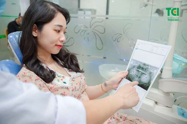 chụp x quang răng ở đâu