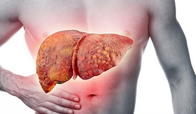 Ung thư gan giai đoạn đầu có điều trị khỏi được không?