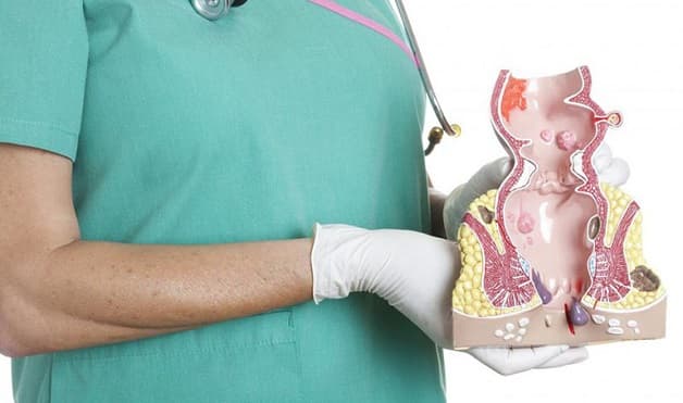 điều trị đại tràng co thắt thể táo bón