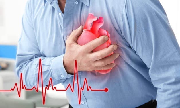 Dấu hiệu của bệnh đột quỵ tim