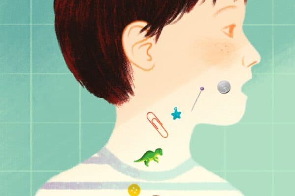 Mắc dị vật họng là tình trạng thường gặp ở trẻ nhỏ 